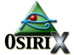 OsiriX Advanced Open-Source PACS Workstation DICOM Viewer