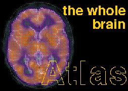 The Whole Brain Atlas